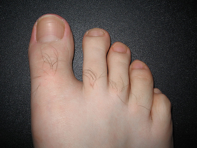 is-there-a-link-between-nail-salons-and-toenail-fungus